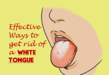 Quick Ways to Get Rid of White Tongue