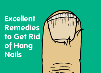 how to Get Rid of Hang Nails
