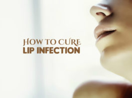 How to Heal a Lip Infection