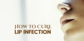 How to Heal a Lip Infection
