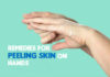 effective remedies for peeling skin on hands