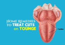 Heal Cuts on Tongue Using Simple Home Remedies