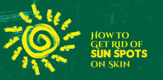 how to get rid of sunspots