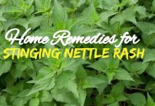 Stinging Nettle Treatment using Home Remedies