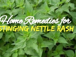 Stinging Nettle Treatment using Home Remedies