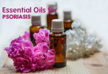 effective ways of Essential Oils for Psoriasis
