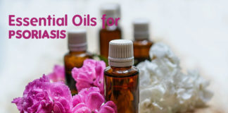 effective ways of Essential Oils for Psoriasis