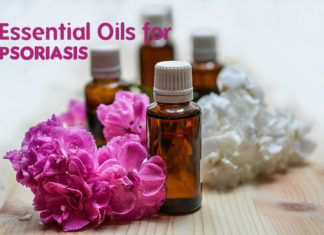 effective ways of Essential Oils for Psoriasis