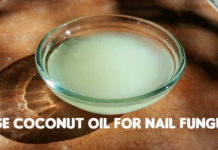 coconut oil for nail fungus