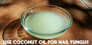 coconut oil for nail fungus