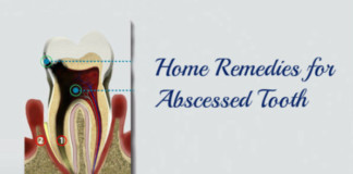 Home Remedies for Abscessed Tooth