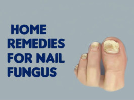 treat nail fungus using home remedies
