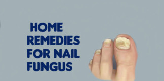 treat nail fungus using home remedies