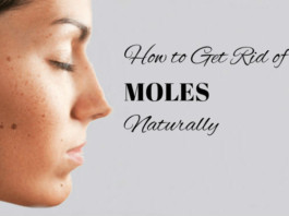 Home remedies to get rid of moles naturally