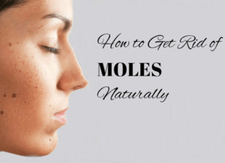 Home remedies to get rid of moles naturally