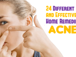 24 Different and Effective Home Remedies for Acne