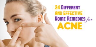 24 Different and Effective Home Remedies for Acne