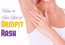 How to Get Rid of Armpit Rash naturally