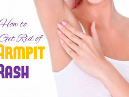 How to Get Rid of Armpit Rash naturally