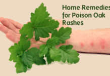 Home remedies for poison oak rash