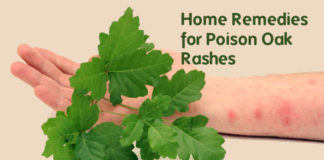 Home remedies for poison oak rash