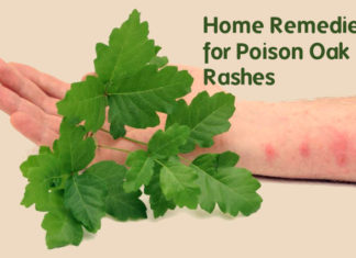 Home remedies for poison oak rash