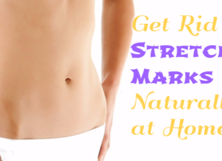 home remedies for stretch marks using natural ingredients