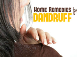 natural remedies for dandruff