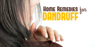 natural remedies for dandruff