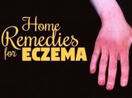 how to get rid of eczema naturally at home