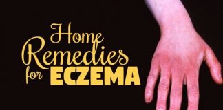 how to get rid of eczema naturally at home