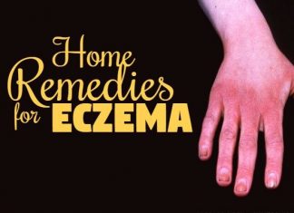 how to get rid of eczema naturally at home