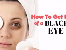 home remedies to get rid of black eye