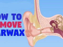 home remedies to get rid of ear wax