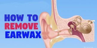 home remedies to get rid of ear wax