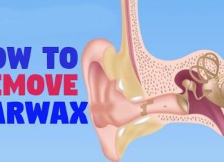 home remedies to get rid of ear wax