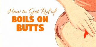 how to get rid of boils on butts