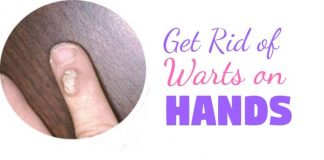 Home Remedies to Get Rid of Warts on Hands and Fingers
