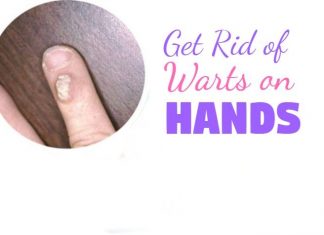 Home Remedies to Get Rid of Warts on Hands and Fingers
