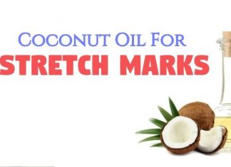 How to use coconut oil for stretch marks