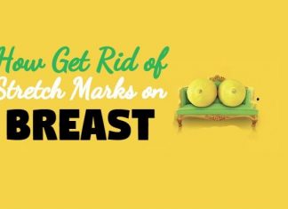 home remedies to get rid of stretch marks on breast