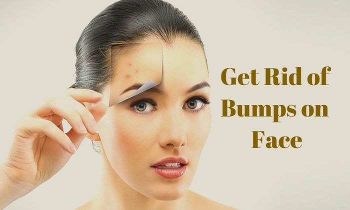 bumps-on-face-natural-remedies-to-treat-naturally