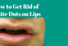 How to Get Rid of White Dots on Lips using natural home remedies