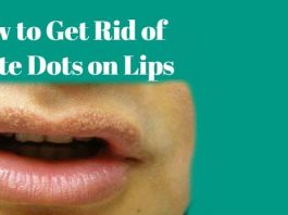 How to Get Rid of White Dots on Lips using natural home remedies