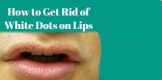 How to Get Rid of White Dots on Lips using natural home remedies