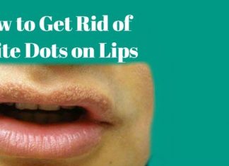 How to Get Rid of White Dots on Lips using natural home remedies