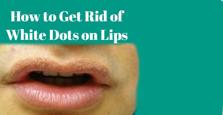 How To Get Rid Of White Spot On Lips