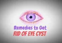 Perfect Remedies to Get Away With an Eye Cyst