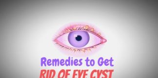 Perfect Remedies to Get Away With an Eye Cyst