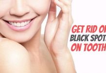 How to Get Rid of Black Spots on Tooth